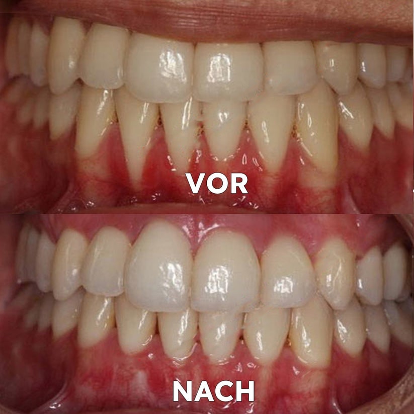 Mineral Powder for Dental Care | Strengthen & Protect Teeth | SmileProtection