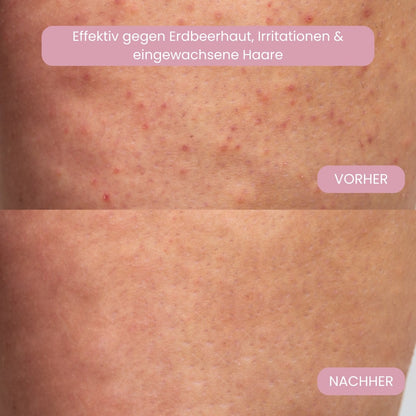 Intimrasierer für Frauen | Elektrischer Damenrasierer für intime Bereiche | Bikini-Trimmer | Femora