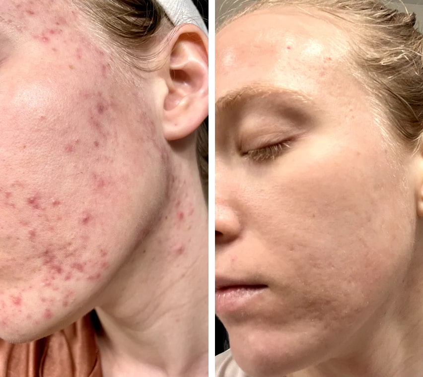 Red Light Mask | LED Face Mask | Skin Light Therapy | SkinGlow