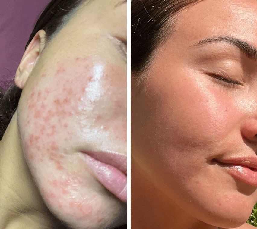 Red Light Mask | LED Face Mask | Skin Light Therapy | SkinGlow