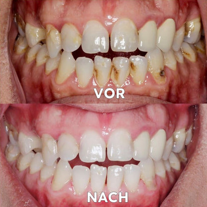 Mineral-Pulver für die Zahnpflege | Stärkt & schützt Zähne | SmileProtection
