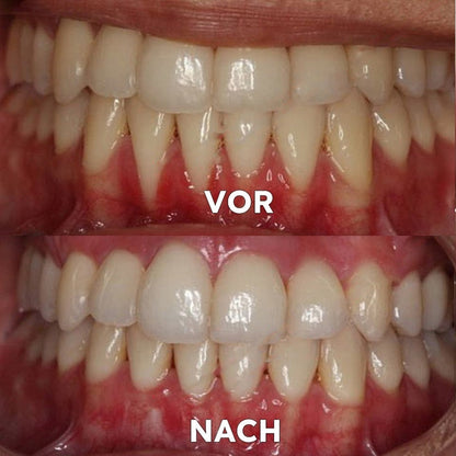 Mineral Powder for Dental Care | Strengthen & Protect Teeth | SmileProtection
