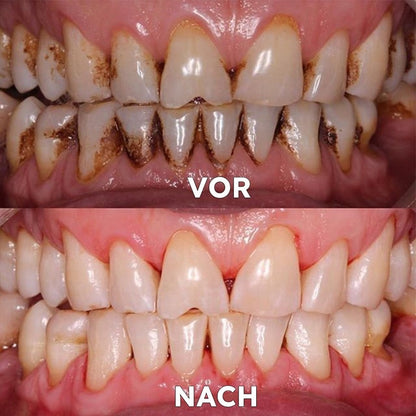 Mineral Powder for Dental Care | Strengthen & Protect Teeth | SmileProtection